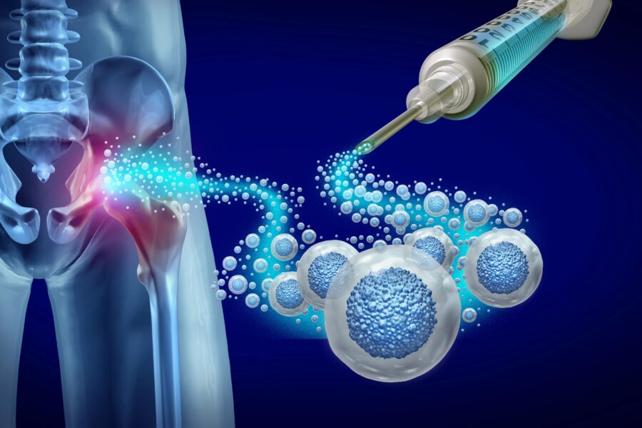 Regenerative Medicine vs Surgery
